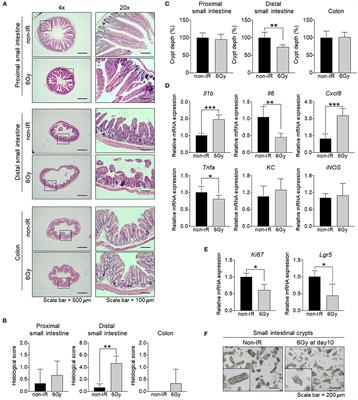 Irradiation-Induced Intestinal Damage Is Recovered by the Indigenous Gut Bacteria Lactobacillus acidophilus